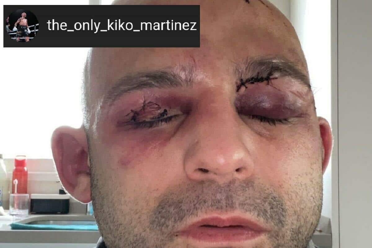 Kiko Martinez face headbutts