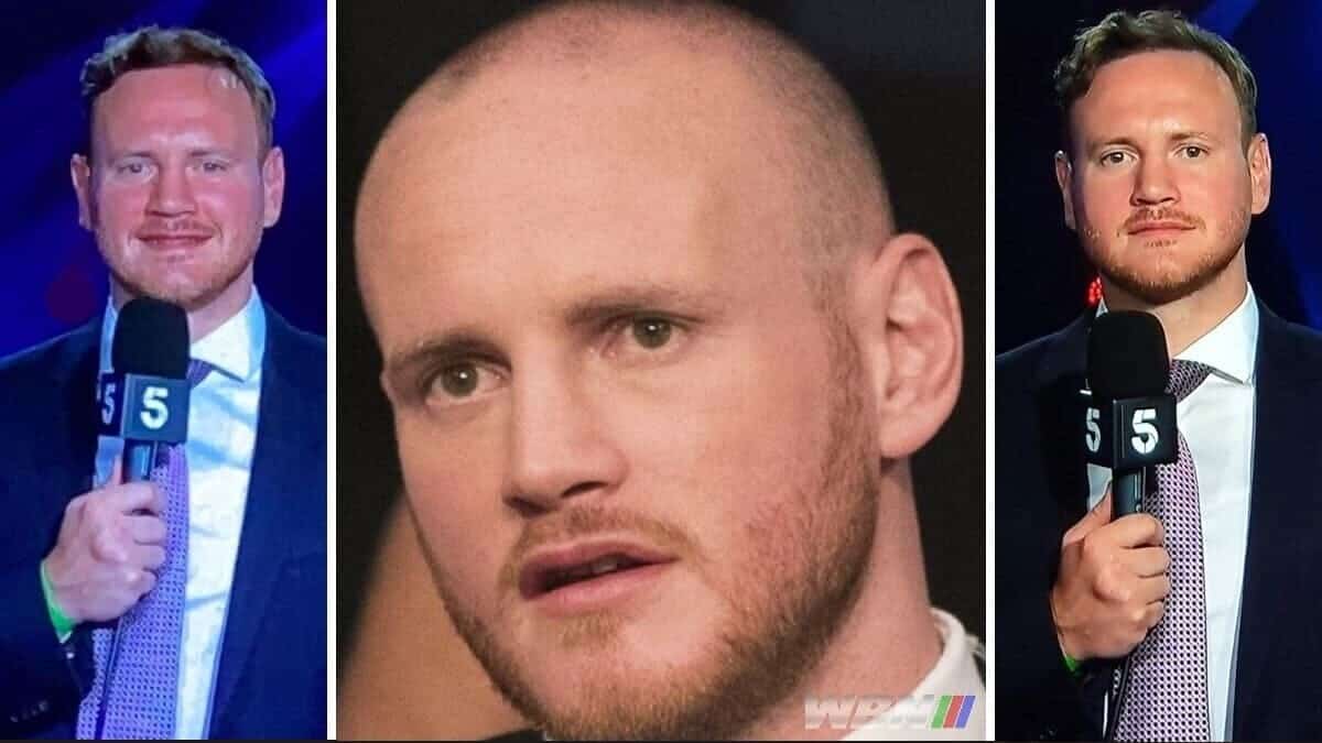 George Groves weight and hair transplant