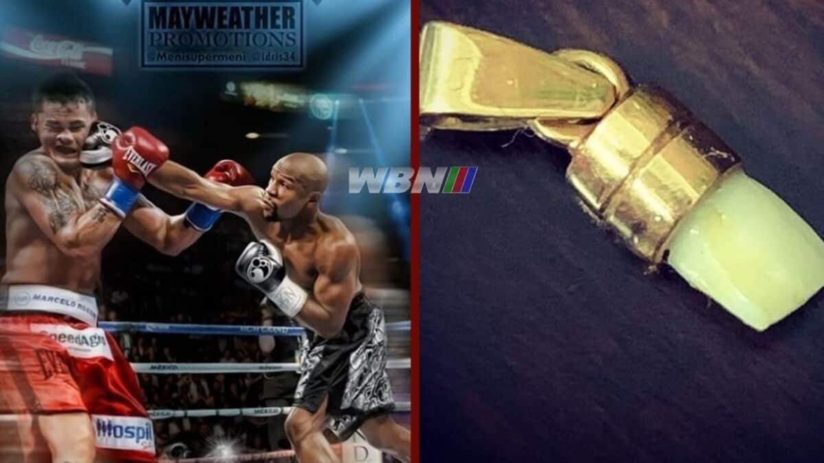 Did Marcos Maidana knock out Floyd Mayweather's tooth?